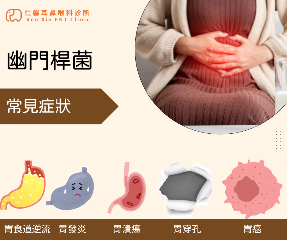 常見幽門桿菌症狀