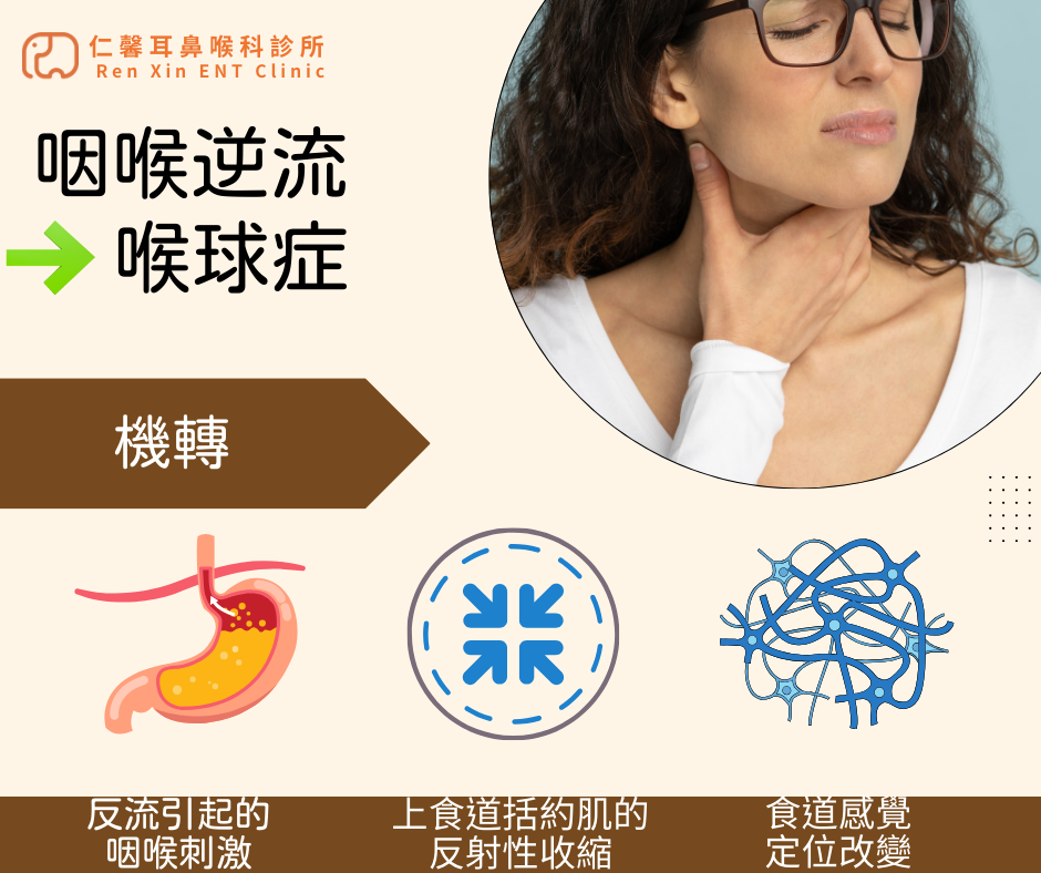 咽喉逆流造成喉嚨卡卡、喉球症的機轉